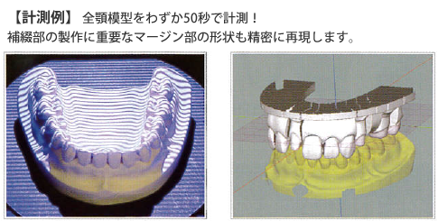 【計測例】 全顎模型をわずか50秒で計測！補綴部の製作に重要なマージン部の形状も精密に再現します。